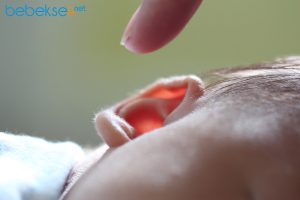 Bebeklerde kepçe kulak
